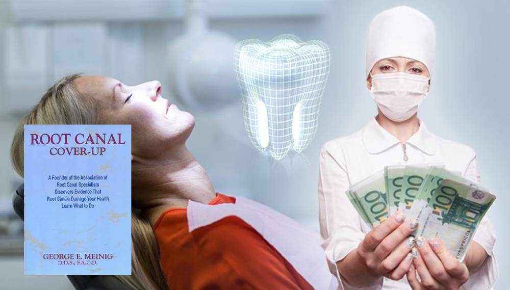 dangers of root canal coverup