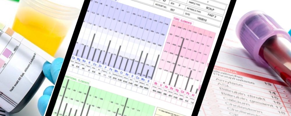 hair tissue mineral vs urine vs blood testing