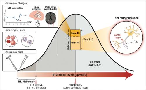 brain atrophy chart